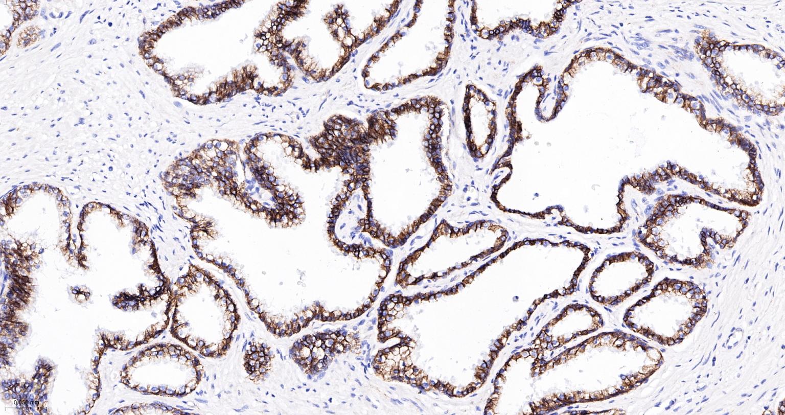 N-cadherin Mouse mAb(bsm-34125