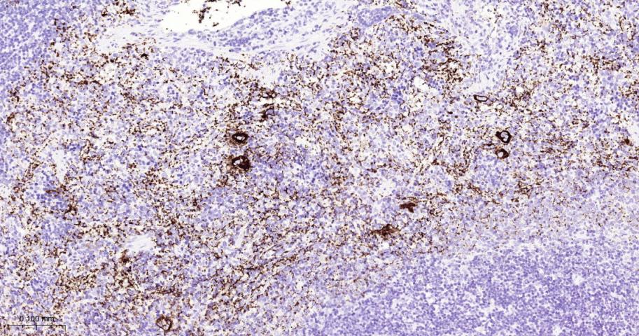 GP1BA Recombinant Rabbit mAb(b