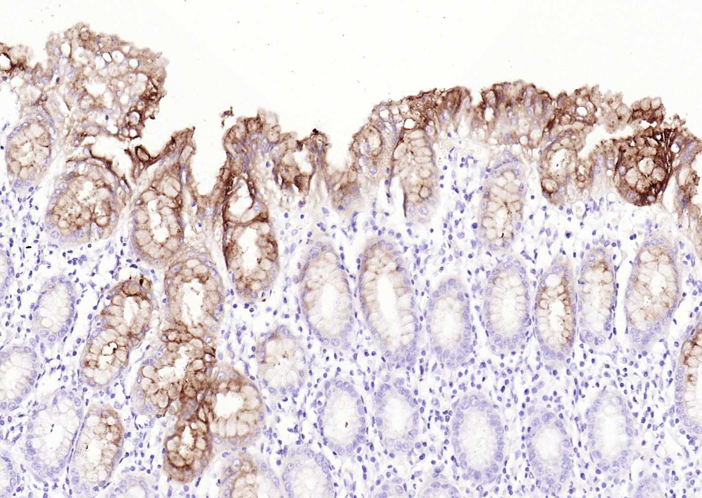 CEACAM5 Mouse mAb(bsm-43141M)-