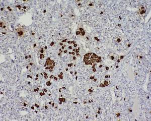 ACTH (7-23) Rabbit pAb(bs-0004