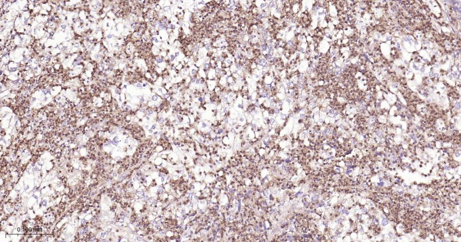 SDHB Recombinant Rabbit mAb(bs