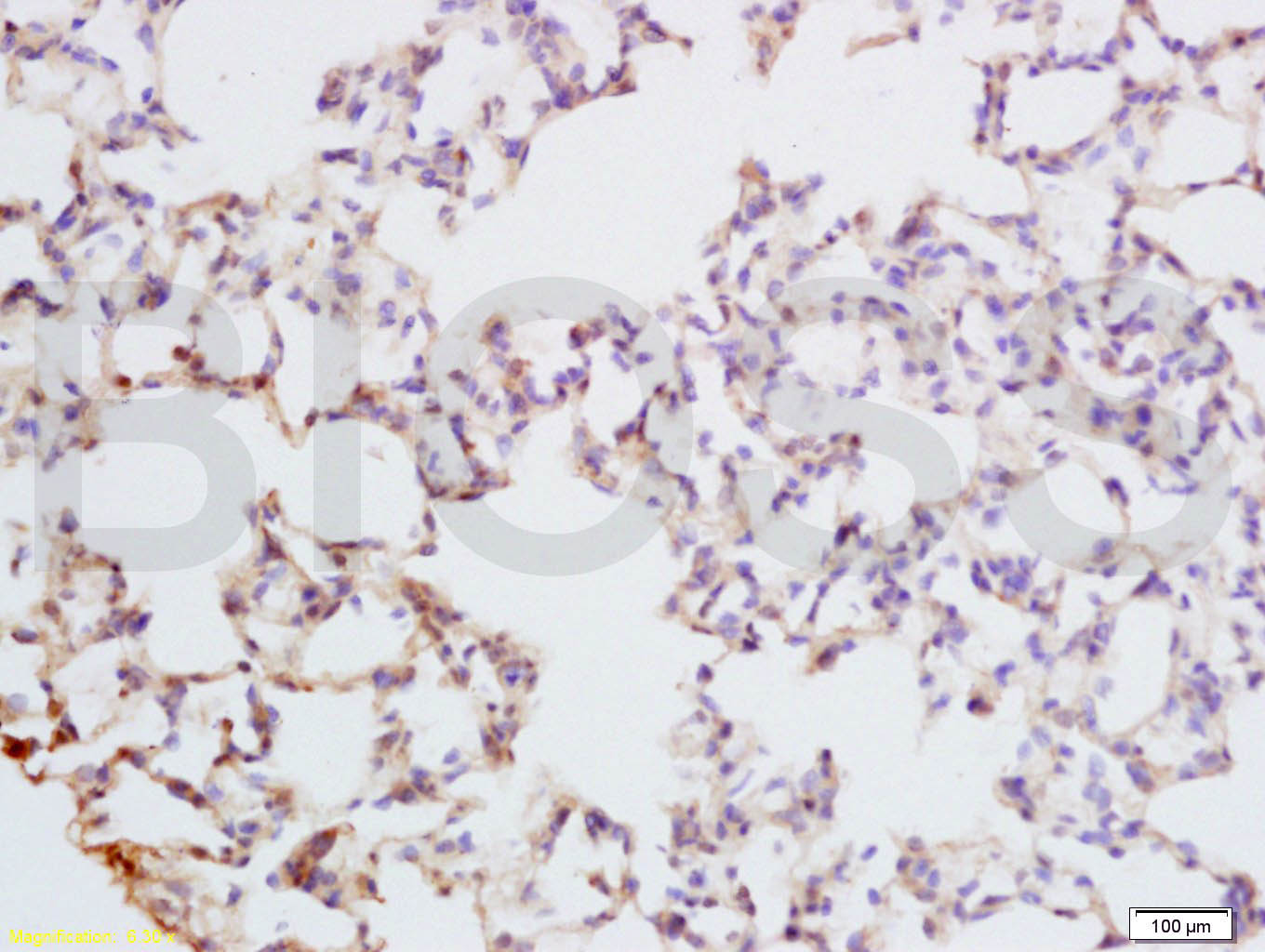 PAX9 Rabbit pAb(bs-1102R)-50ul