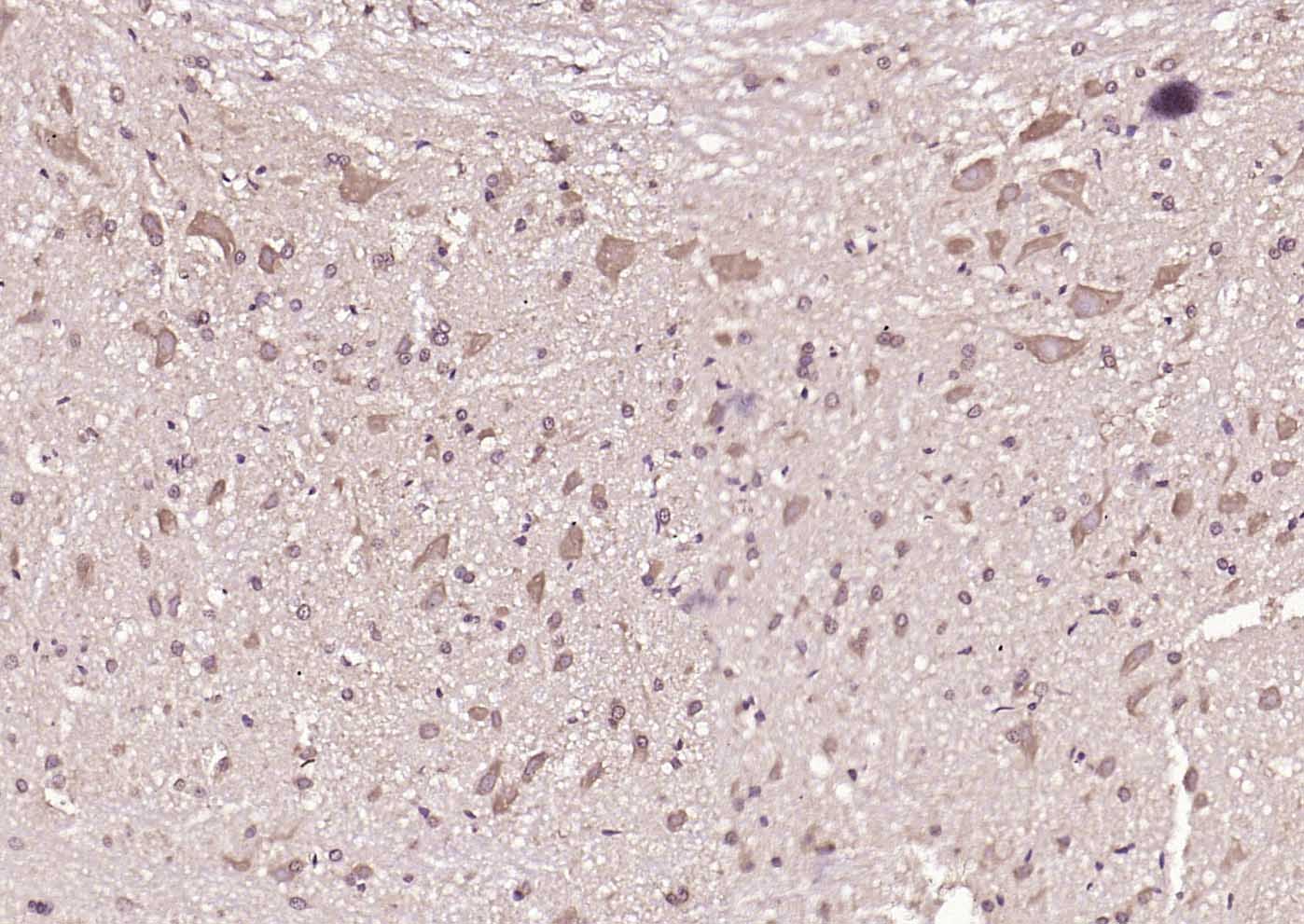 MLC1 Rabbit pAb(bs-7115R)-50ul