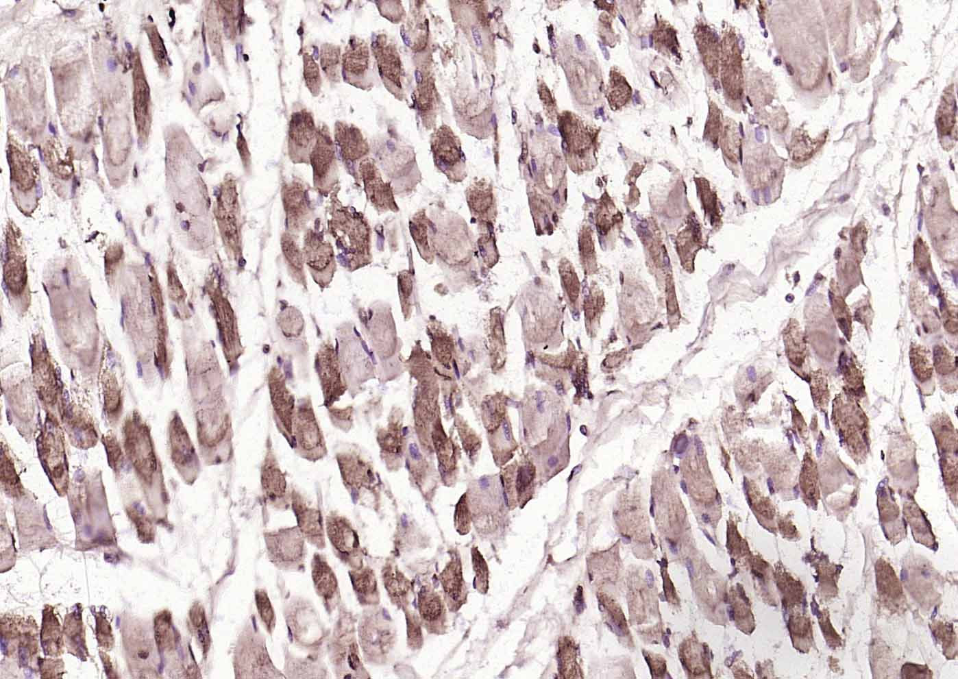 AMPK beta 1/PRKAB1 Rabbit pAb(