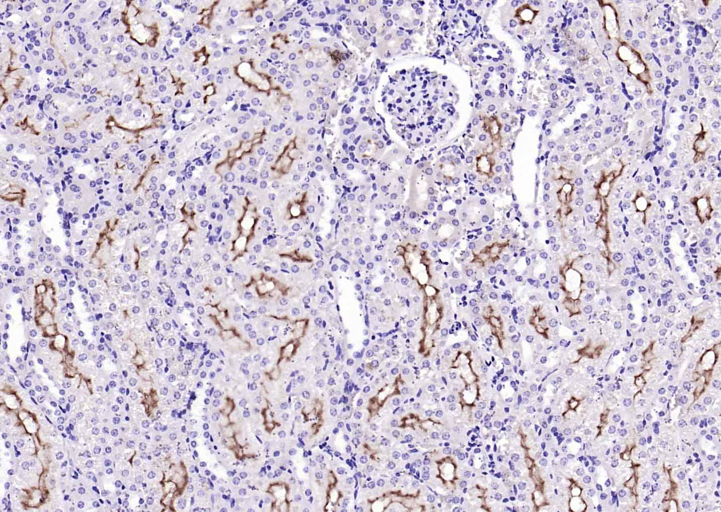 Transmembrane protein 30A Rabb