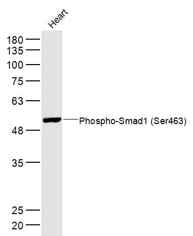 phospho-Smad1 (Ser463) Rabbit 