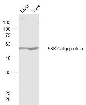 58K Golgi protein Rabbit pAb(b