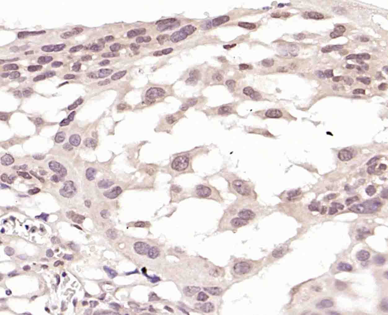 KLF6 Rabbit pAb(bs-1395R)-50ul