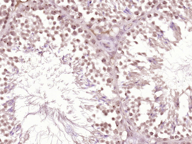 phospho-DNA PKcs (Thr2609) Rab