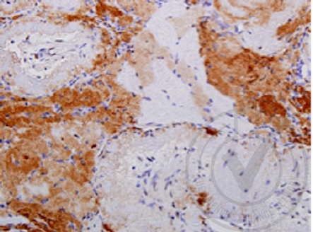 phospho-Bcl-xL (Thr115) Rabbit