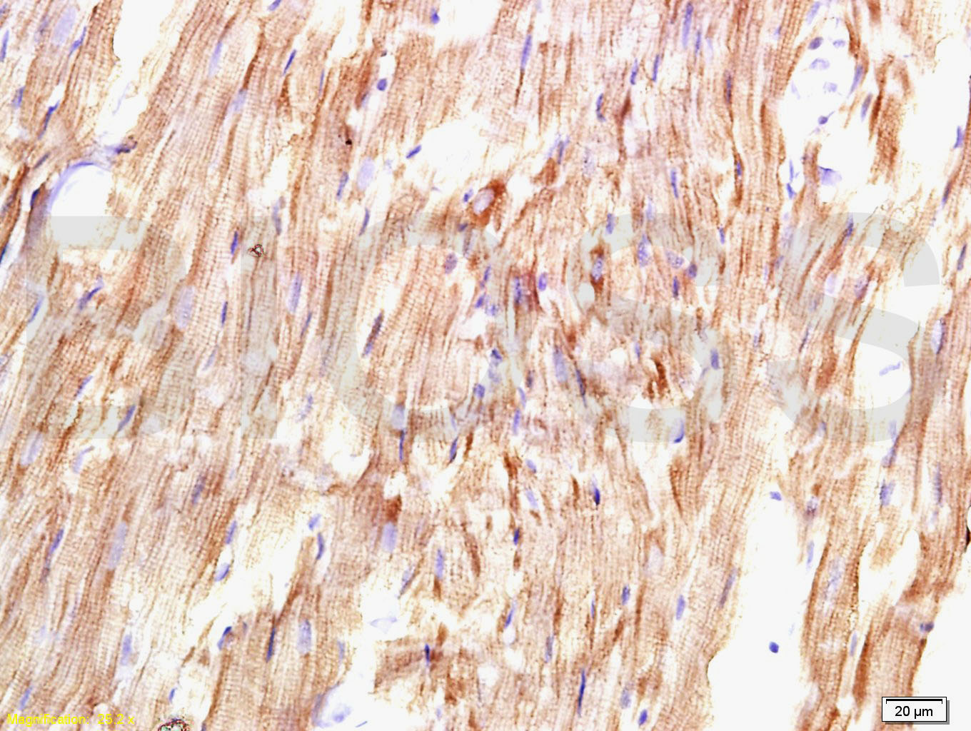 Angiotensin II Type 1 Receptor