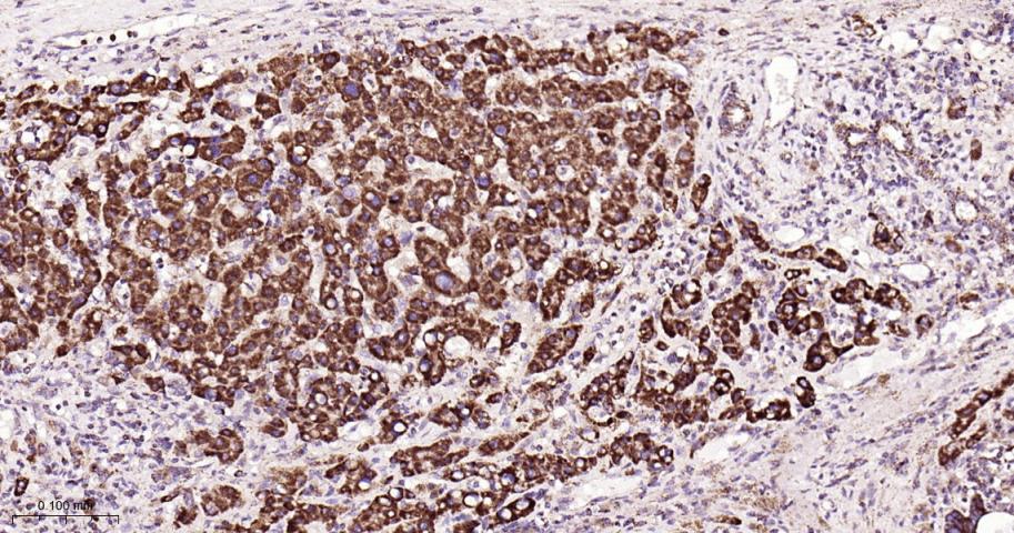 SDHB Recombinant Rabbit mAb(bs