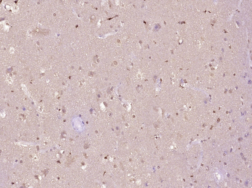 phospho-HP1 alpha (Ser92) Rabb