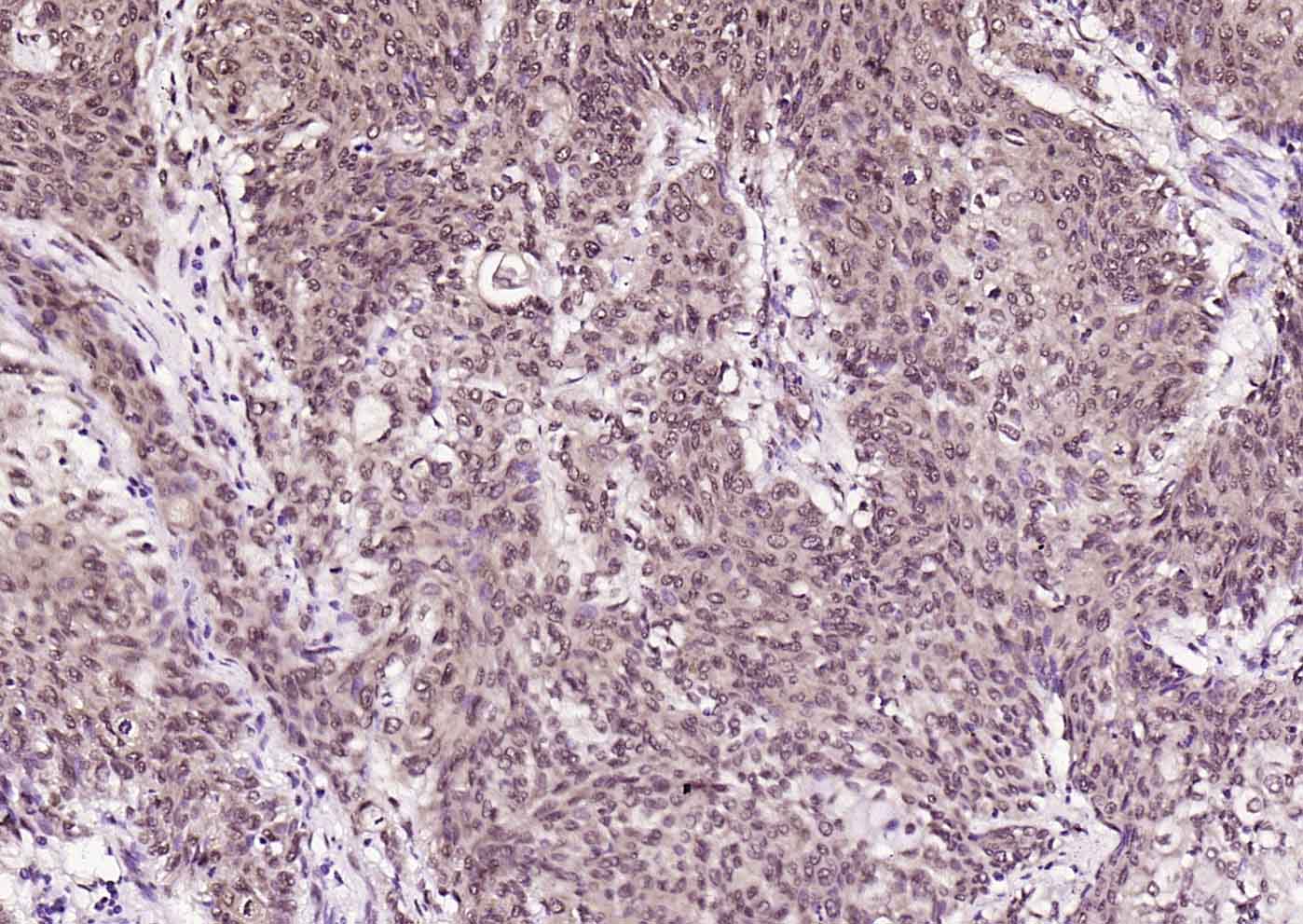 AMPK beta 1/PRKAB1 Rabbit pAb(