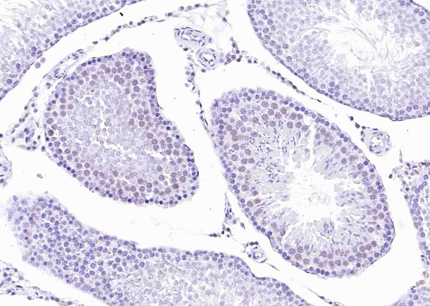 BRCA2 Rabbit pAb(bs-1210R)-50u