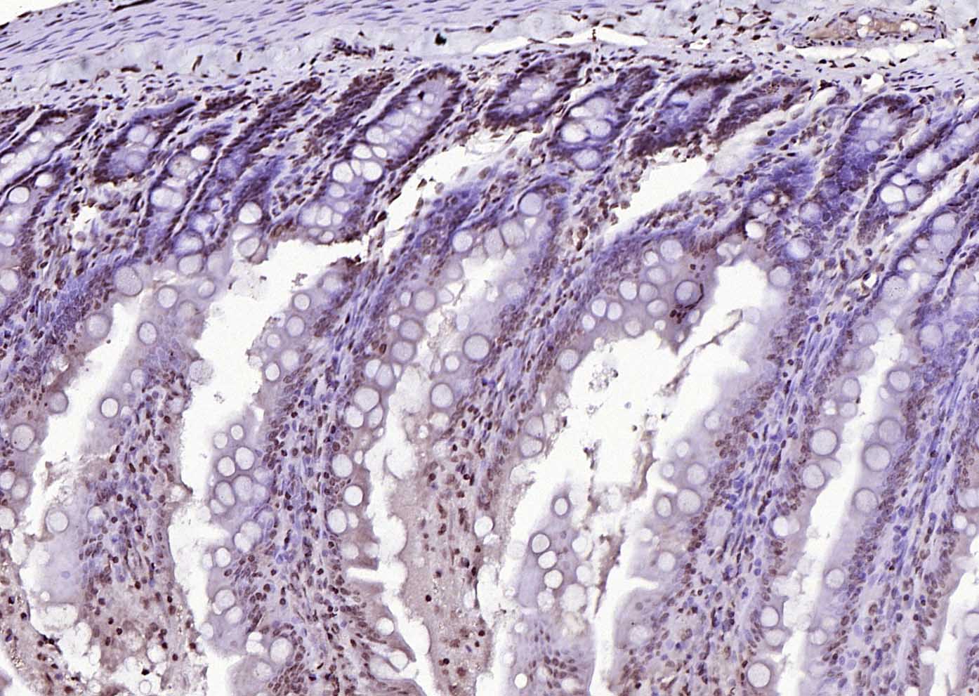 AMIGO2 Rabbit pAb(bs-11450R)-5