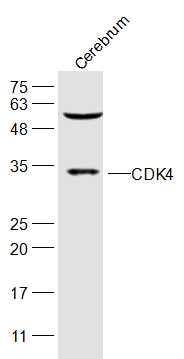 CDK4 Rabbit pAb(bs-0633R)-50ul