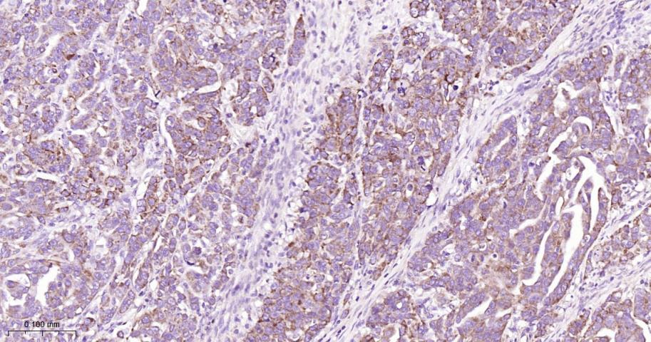 CPT1A Rabbit pAb(bs-2047R)-50u