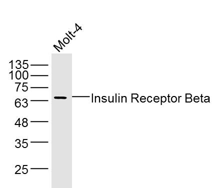 Insulin Receptor Beta Rabbit p