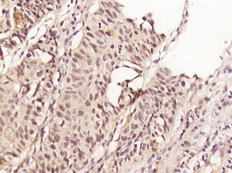 CENPE Rabbit pAb(bs-8846R)-50u