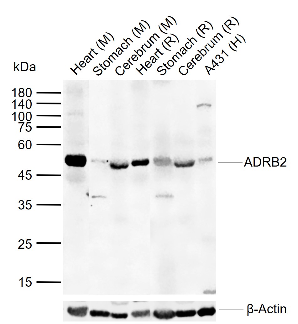 ADRB2 Rabbit pAb(bs-0947R)-50u