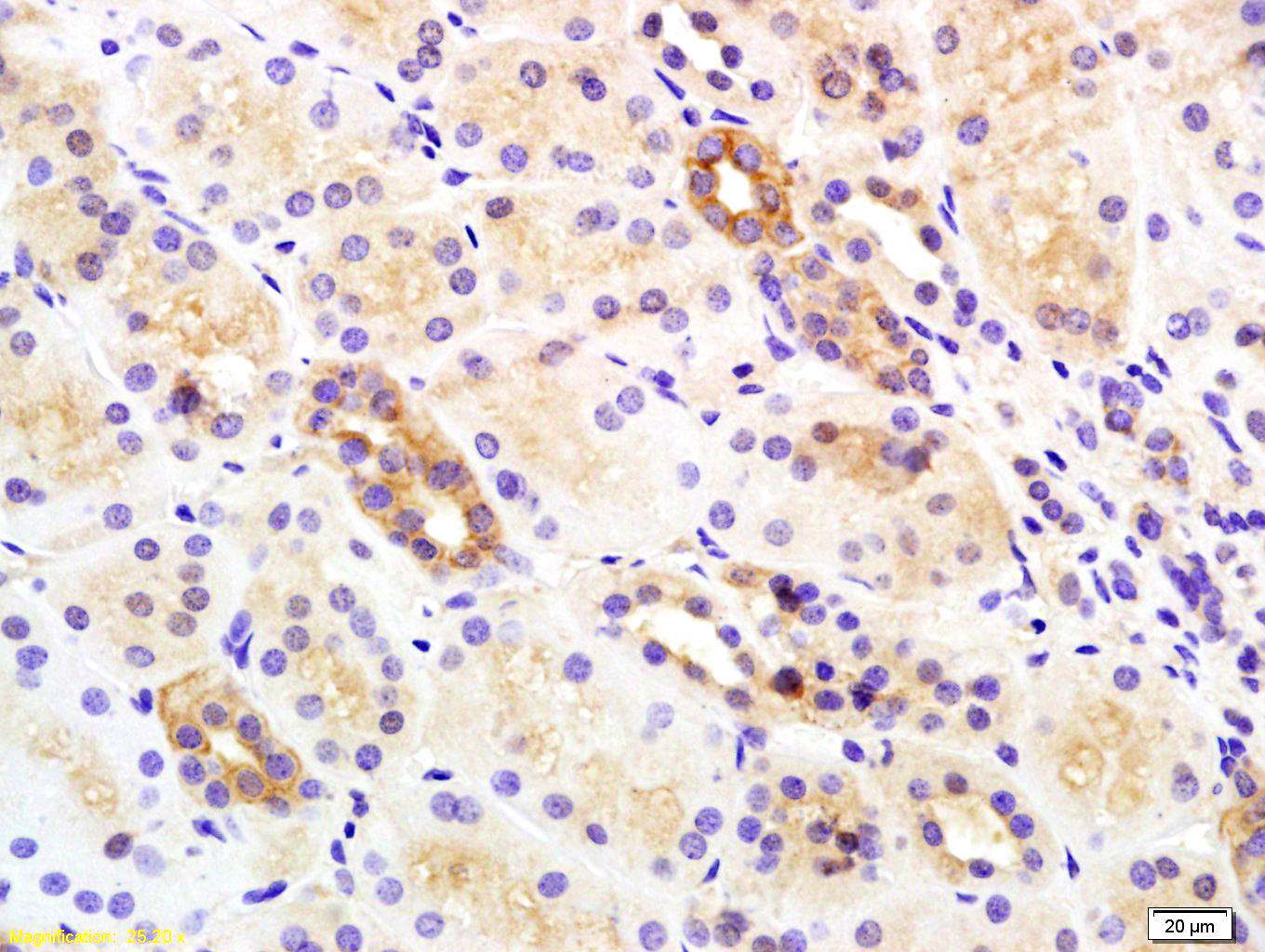 Insulin Receptor Beta Rabbit p