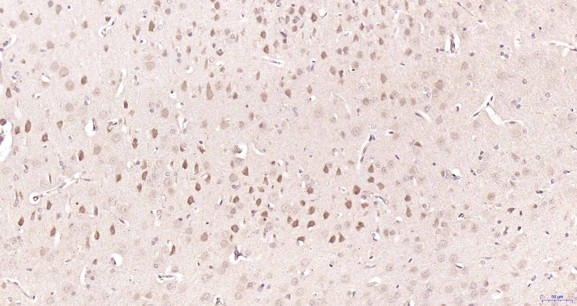 PSME3 Rabbit pAb(bs-4222R)-50u