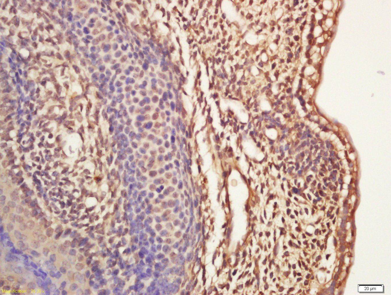 ASCL1 Rabbit pAb(bs-1155R)-50u