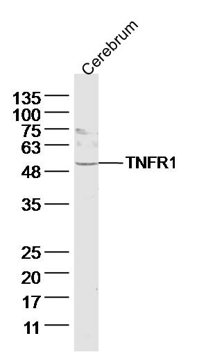 TNFR1 Rabbit pAb(bs-2941R)-50u