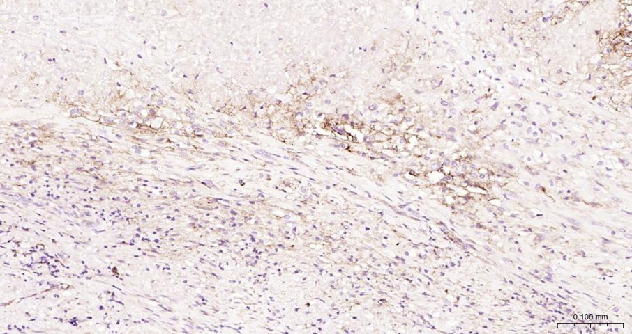 ICAM1 Rabbit pAb(bs-0608R)-50u