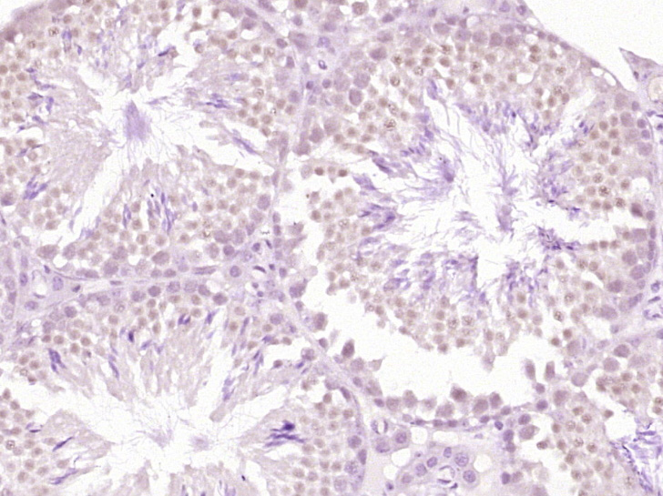 TKTL1 Rabbit pAb(bs-6284R)-50u