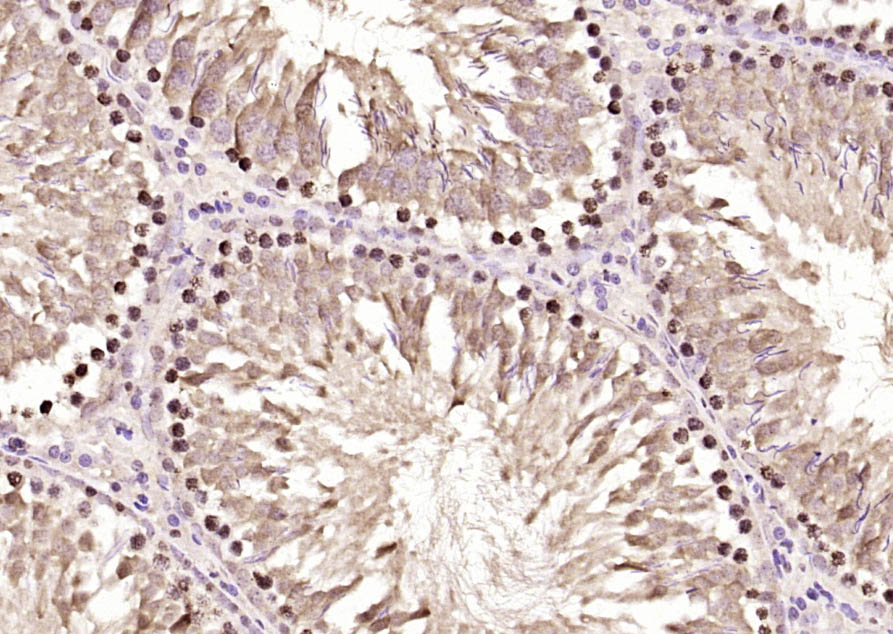 IGF2BP1 Rabbit pAb(bs-8683R)-5