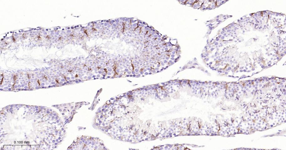 ITGB3 Recombinant Rabbit mAb(b