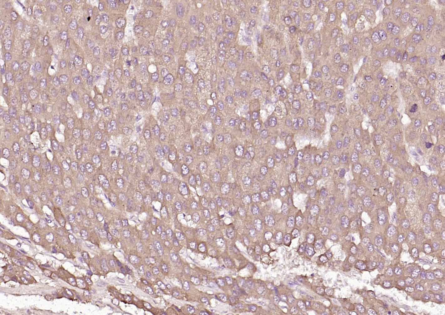 P4HB Recombinant Mouse mAb(bsm