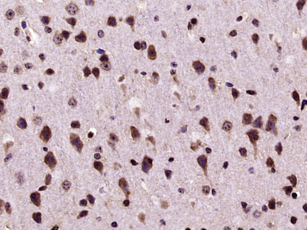 SMURF2 Rabbit pAb(bs-4056R)-50