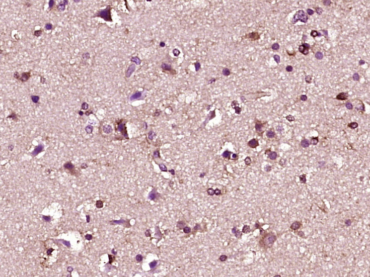 Fbxw7 Rabbit pAb(bs-8394R)-50u