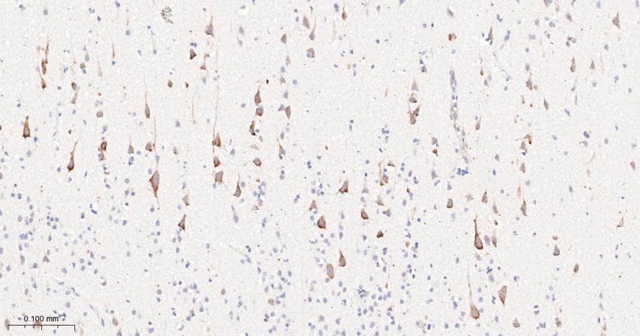 phospho-FoxO3a (Ser253) Recomb