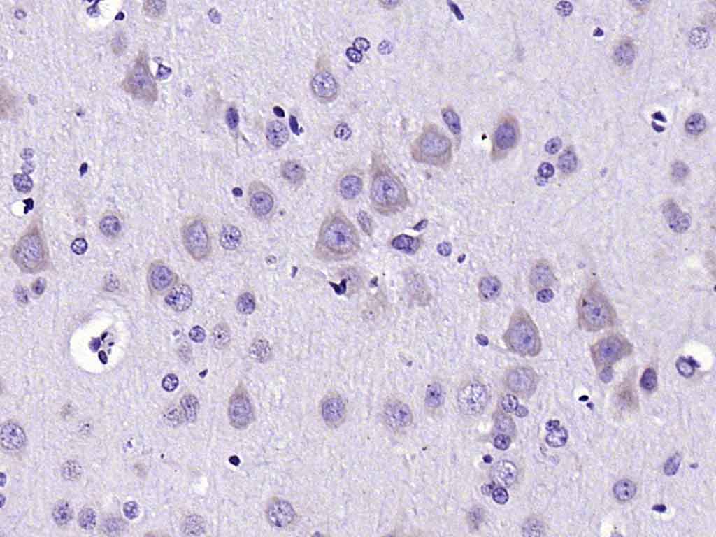 CH25H Rabbit pAb(bs-6480R)-50u