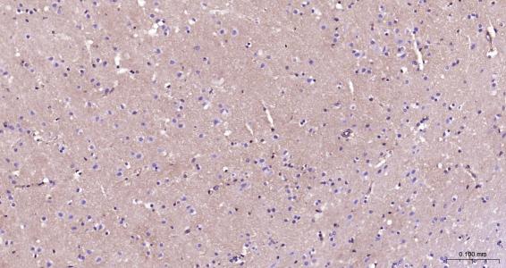 Integrin Alpha V Rabbit pAb(bs