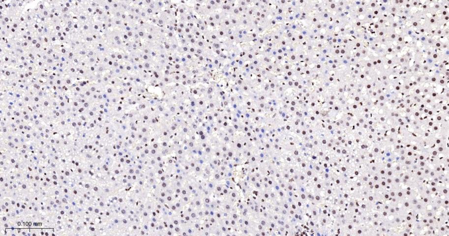 KDM4B Recombinant Rabbit mAb(b