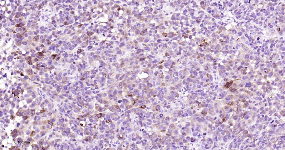 Melan A Recombinant Rabbit mAb