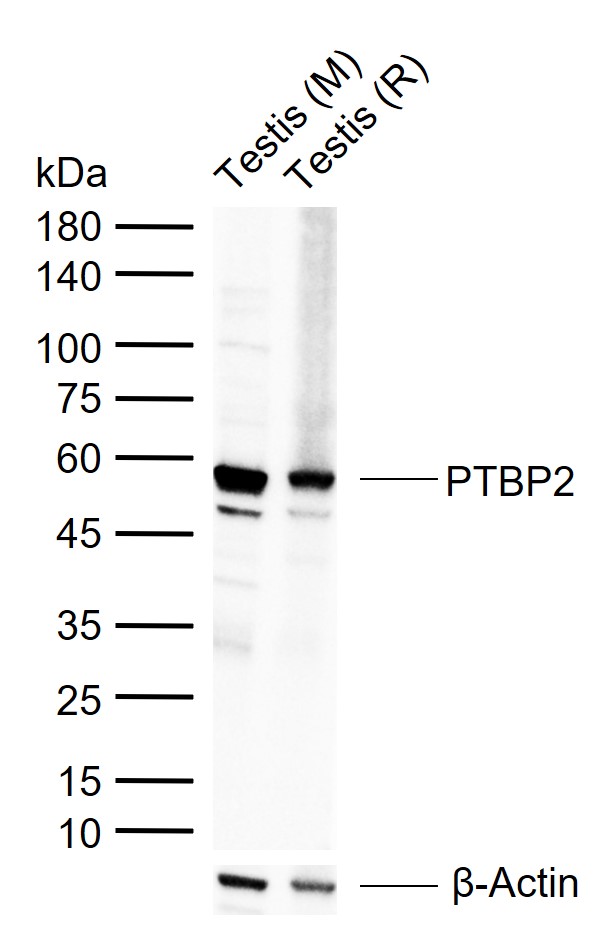 PTBP2 Rabbit pAb(bs-11928R)-50