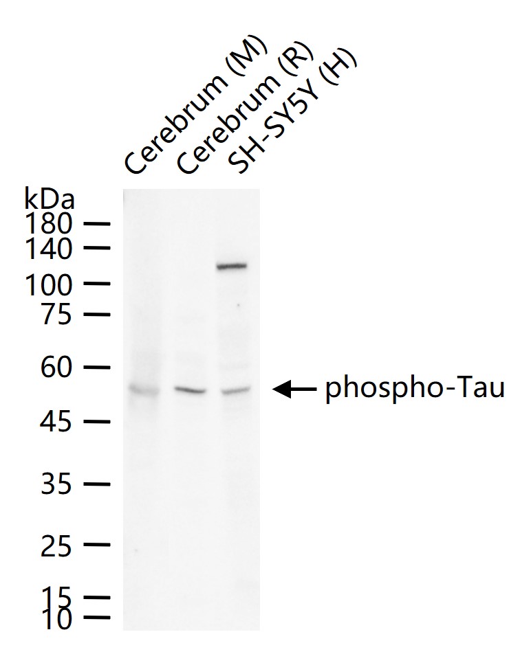 phospho-Tau Protein (Thr181) R