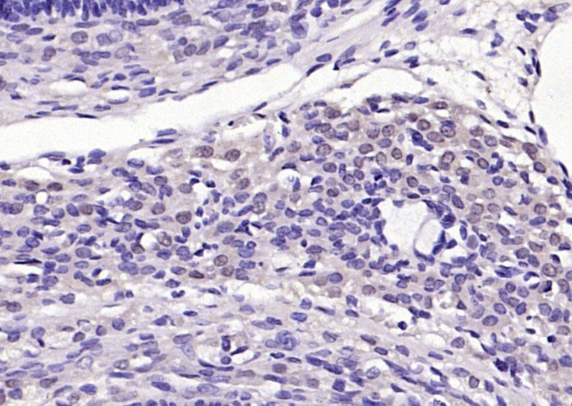 TORC2 Rabbit pAb(bs-3590R)-50u