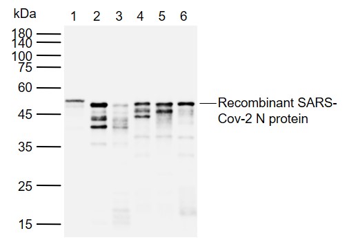 SARS-CoV-2 (2019-nCoV) Nucleoc