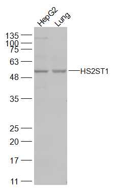 HS2ST1 Rabbit pAb(bs-17389R)-5