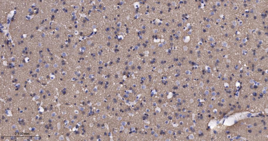 Synaptophysin Recombinant Rabb