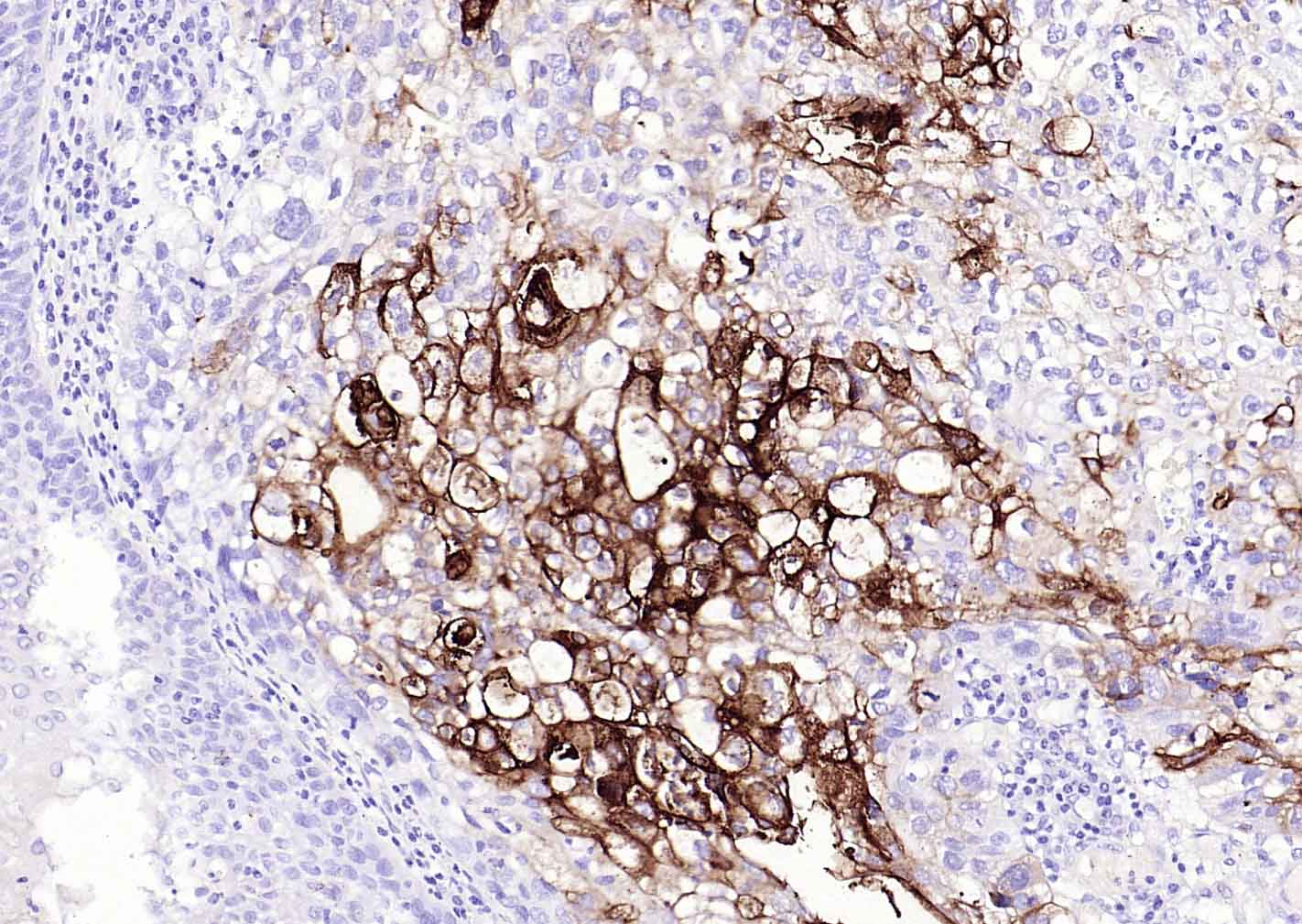 CEACAM5 Mouse mAb(bsm-43141M)-