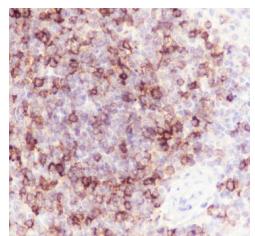 CD1c Recombinant Rabbit mAb(bs