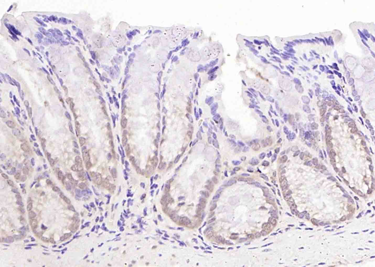 LKB1 Rabbit pAb(bs-3948R)-50ul